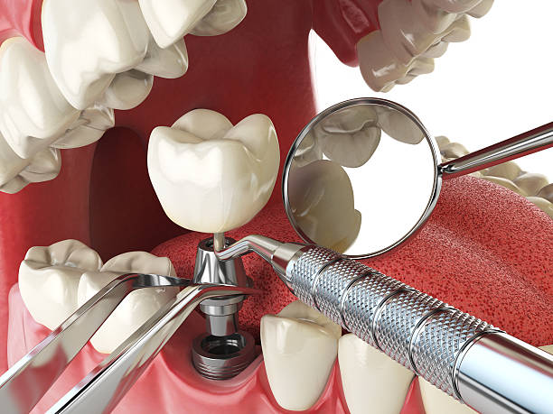 Best Emergency Treatment for Toothache in Soh Jordan, UT